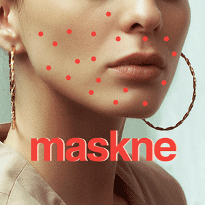 How to get rid of maskne: 7 Tried-and-tested methods that worked for me