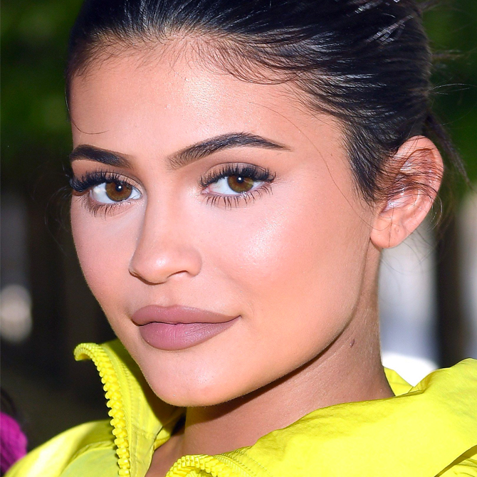 Kylie Jenner lip fillers