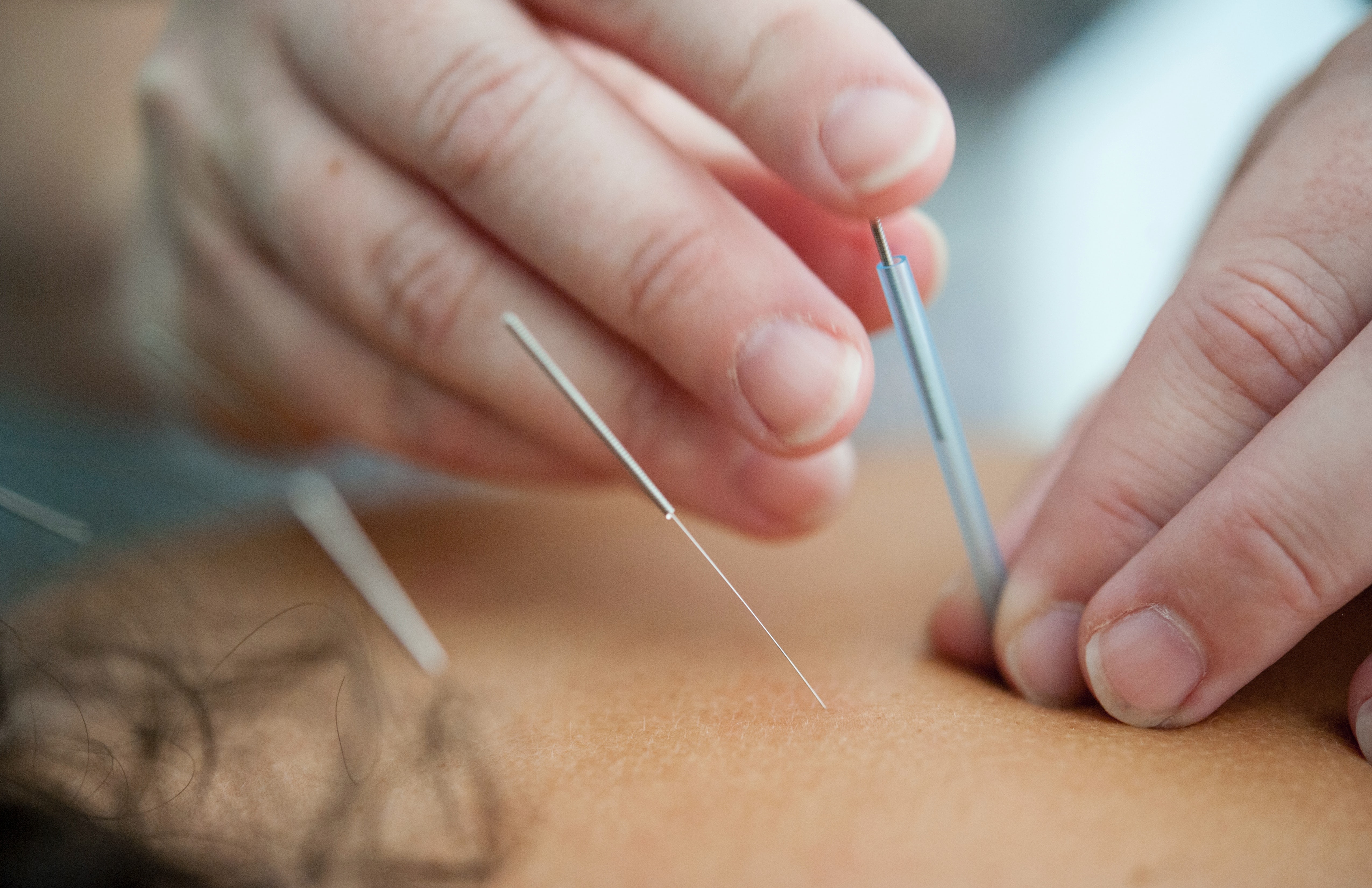 8 Best Acupuncture treatment centres in the Klang Valley (фото 4)