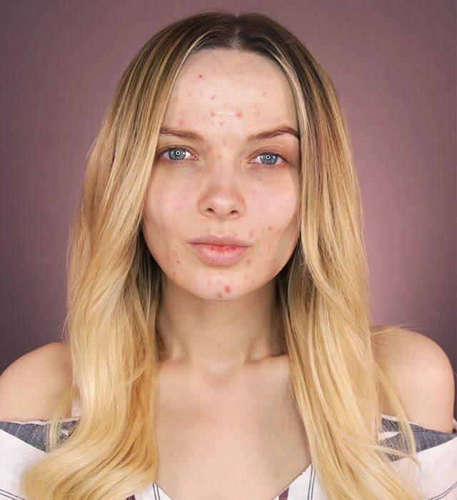 #YouLookDisgusting: This vlogger’s struggle with beauty shaming is what’s wrong with the world today (фото 2)