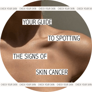 Is it really just a mole? This dermatologist teaches us how to spot skin cancer Is it really just a mole? This dermatologist teaches us how to spot skin cancer