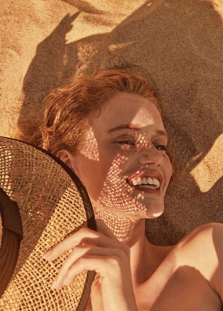 I was diagnosed with a sun allergy—here’s what I’ve learned
