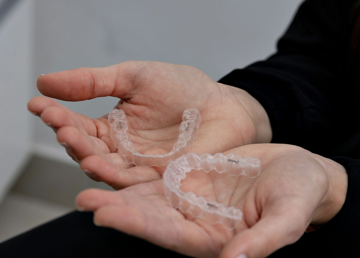 Beauty Diaries: What I Wish I Knew Before I Got Clear Aligners
